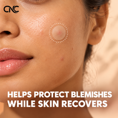 Nighttime Acne Pimple Patches